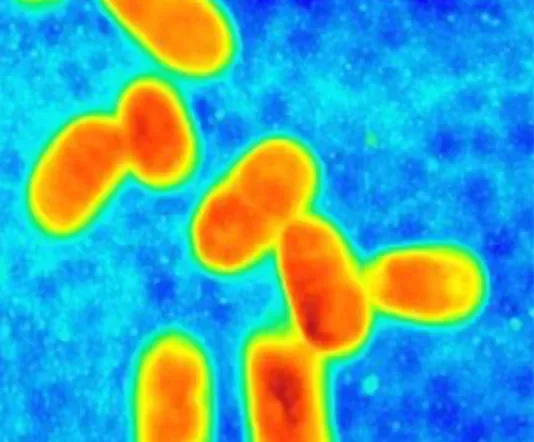 bacteria scan result in atomic force microscopy